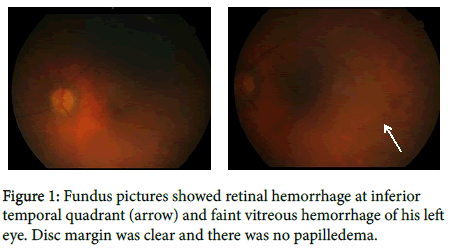 ophthalmic-pathology-Fundus-pictures