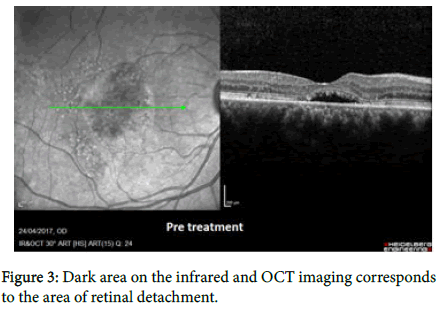 ophthalmic-pathology-OCT-imaging