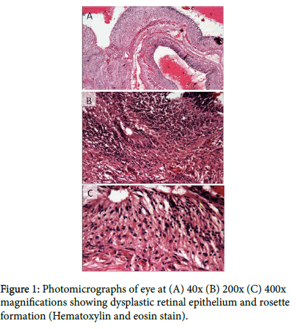 ophthalmic-pathology-Photomicrographs