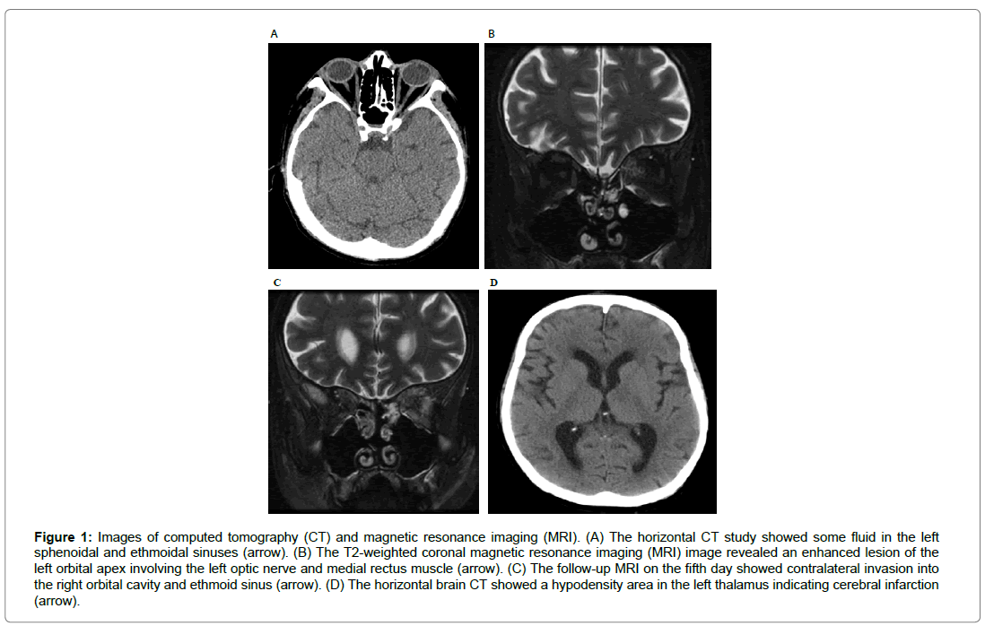 ophthalmic-pathology-computed-tomography