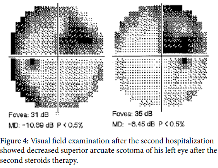 ophthalmic-pathology-left-eye