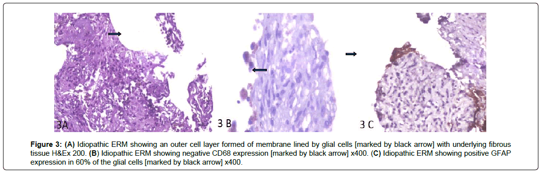 ophthalmic-pathology-outer-cell-layer