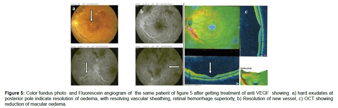 ophthalmic-pathology-pole-indicate