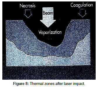 optics-photonics-Thermal-zones