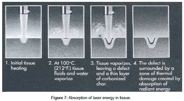 optics-photonics-laser-energy