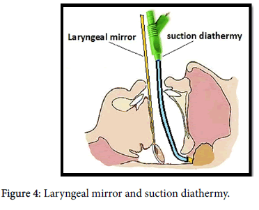otology-Laryngeal