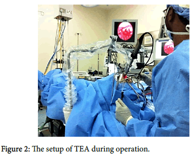 otology-TEA