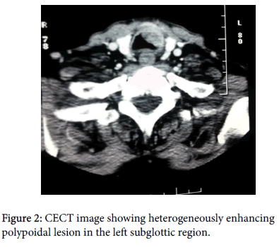 otology-rhinology-CECT-image