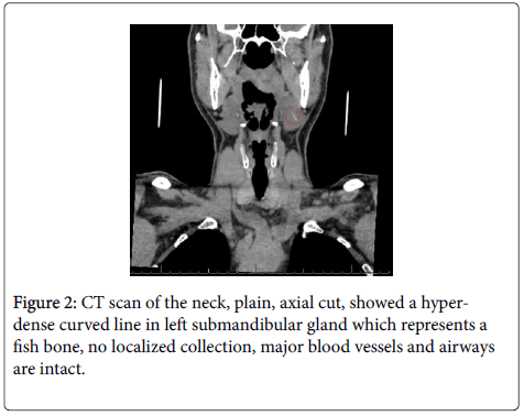 otology-rhinology-CT-scan