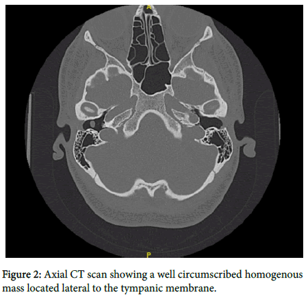 otology-rhinology-CT-scan