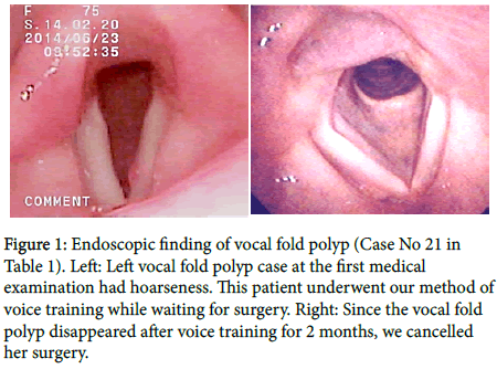 otology-rhinology-Endoscopic