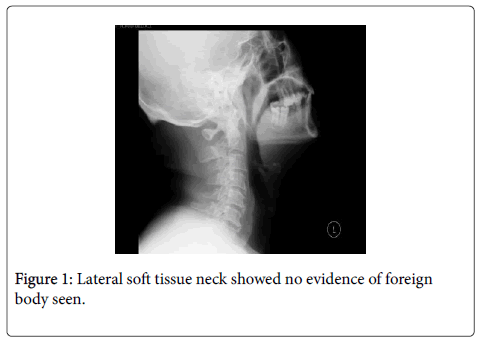 otology-rhinology-Lateral-soft