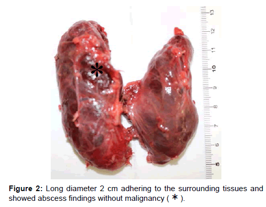 otology-rhinology-Long-diameter