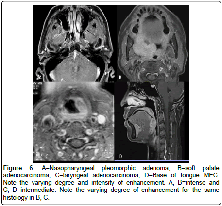 otology-rhinology-Nasopharyngeal