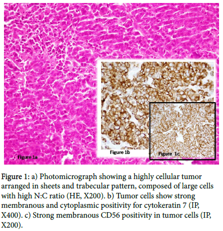 otology-rhinology-Photomicrograph