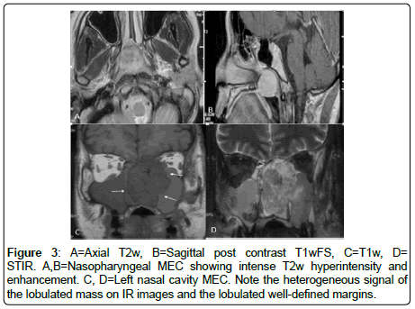 otology-rhinology-Sagittal-post