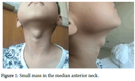 otology-rhinology-Small-mass
