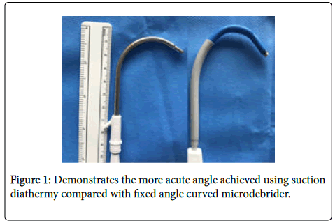otology-rhinology-acute-angle