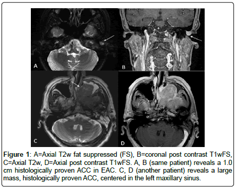 otology-rhinology-coronal-post