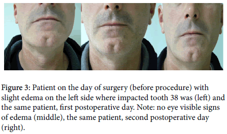 otology-rhinology-eye-visible