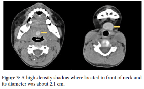 otology-rhinology-high-density