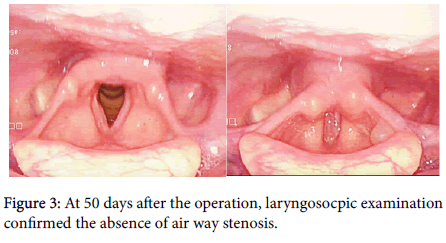 otology-rhinology-laryngosocpic