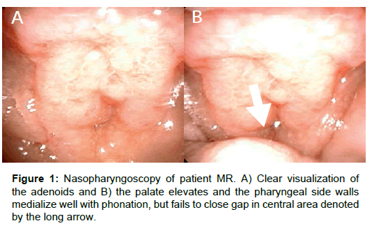 otology-rhinology-nasopharyngoscopy-patient