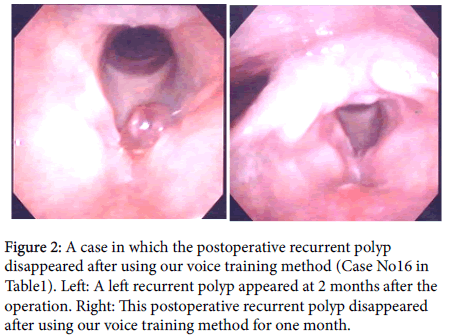 otology-rhinology-postoperative