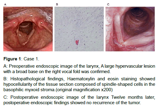 otology-rhinology-preoperative-endoscopic