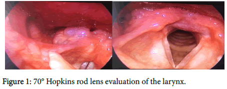 otology-rhinology-rod-lens