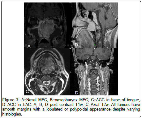 otology-rhinology-smooth-margins