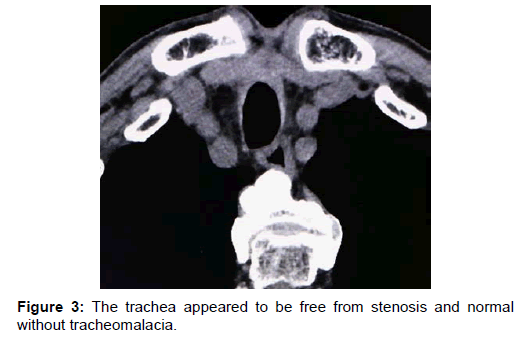 otology-rhinology-tracheomalacia