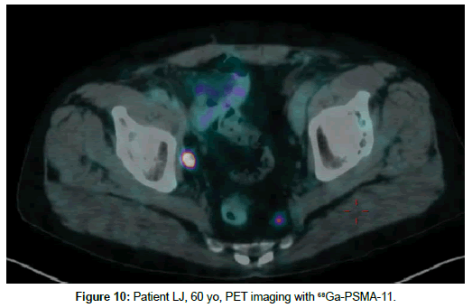 pharmaceutical-sciences-PET-imaging