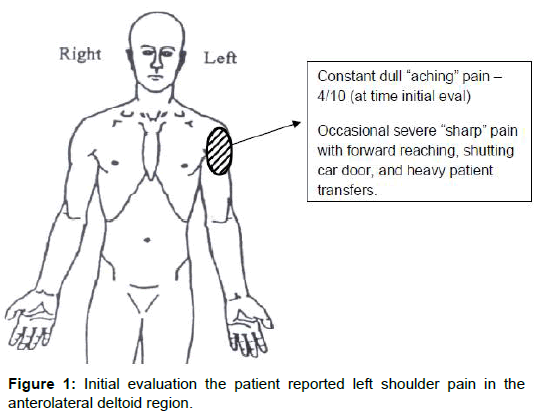 physiotherapy-rehabilitation-anterolateral-deltoid-region