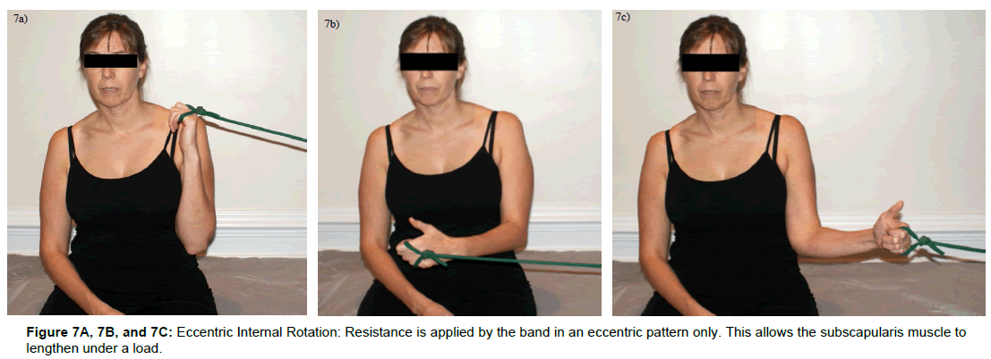 physiotherapy-rehabilitation-subscapularis-muscle