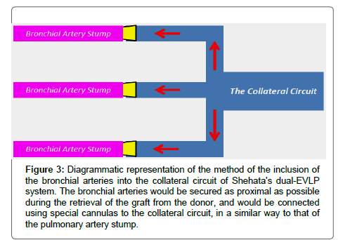 pulmonary-medicine-collateral-circuit