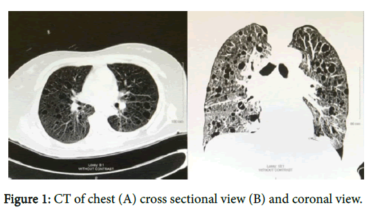 pulmonary-medicine-coronal-view