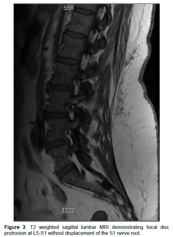 regenerative-medicine-MRI-demonstrating