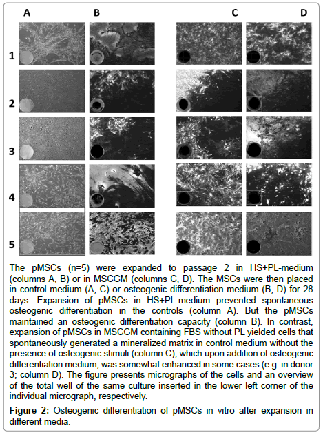 regenerative-medicine-Osteogenic-differentiation