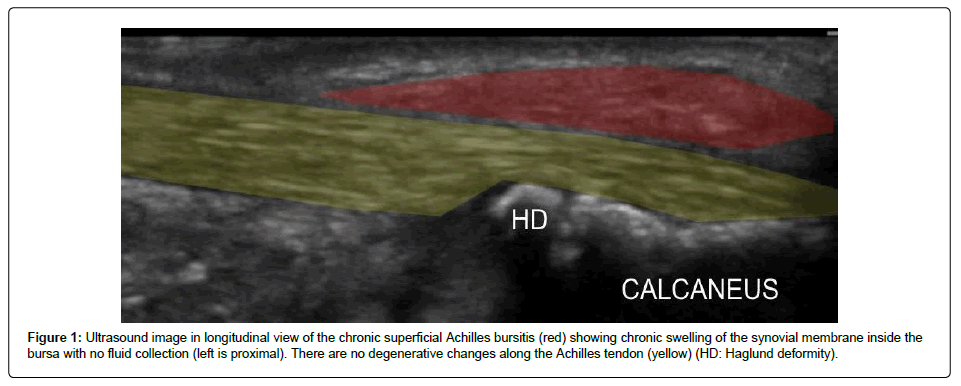 regenerative-medicine-Ultrasound-image