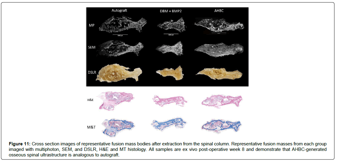 regenerative-medicine-autograft-treatment