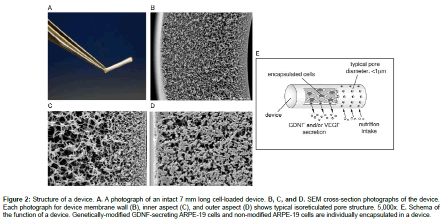 regenerative-medicine-cell-loaded