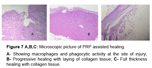 regenerative-medicine-collagen-tissue