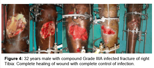 regenerative-medicine-compound-grade