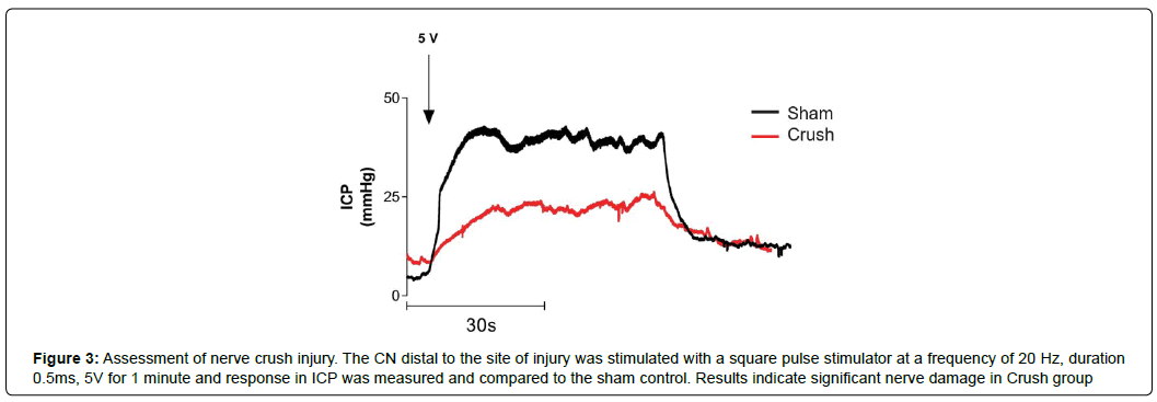 regenerative-medicine-crush-injury