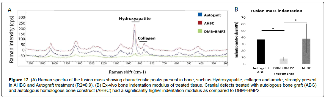 regenerative-medicine-homologous-bone