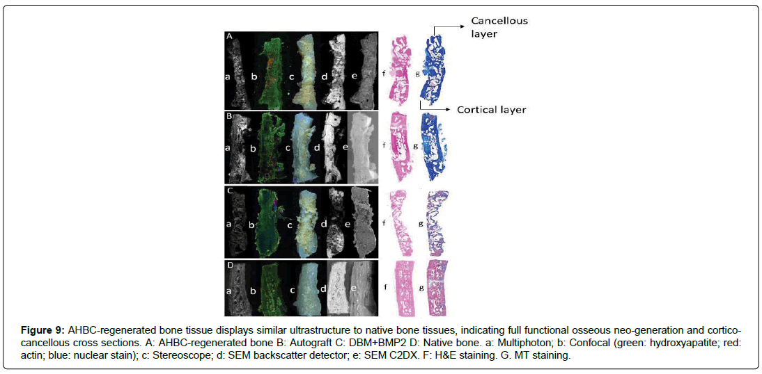 regenerative-medicine-hydroxyapatite