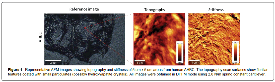 regenerative-medicine-hydroxyapatite-crystals