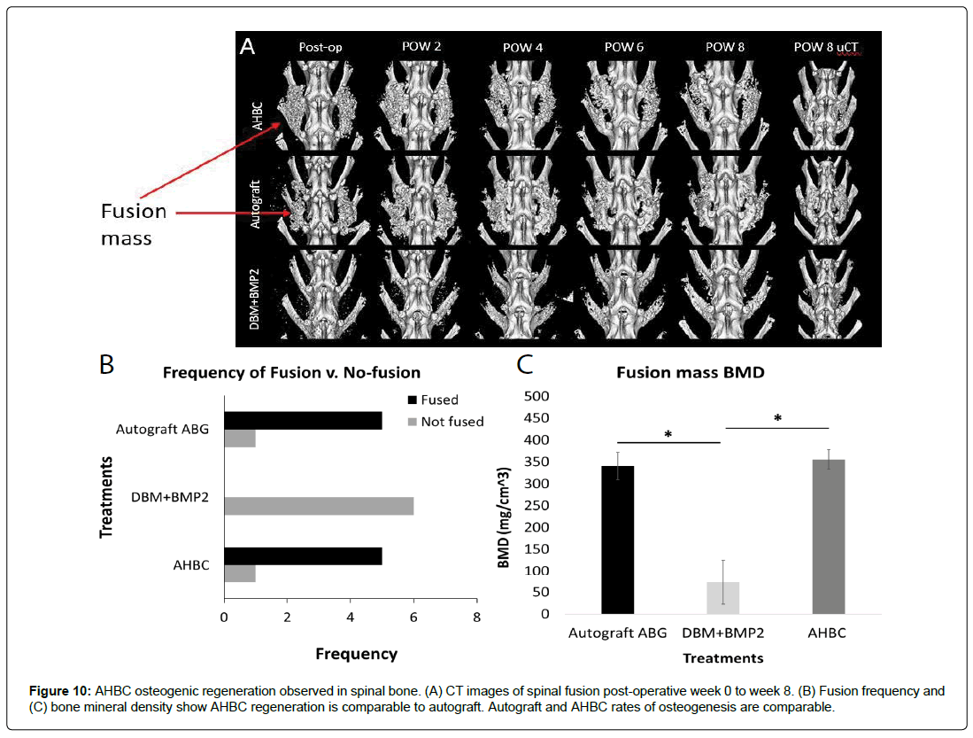 regenerative-medicine-osteogenesis