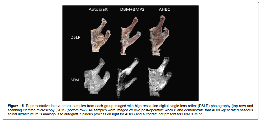 regenerative-medicine-spinous-process